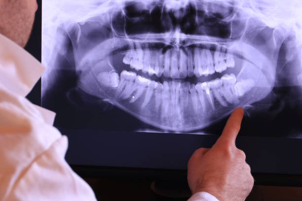 Best Emergency Treatment for Dental Infections or Abscesses in Sandy, OR