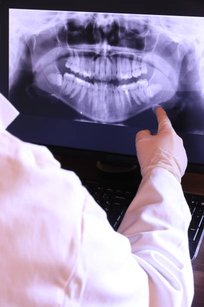 Best Emergency Dental Care for Broken or Chipped Teeth in Sandy, OR
