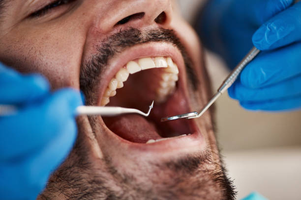 Best Emergency Treatment for Dental Infections or Abscesses in Sandy, OR